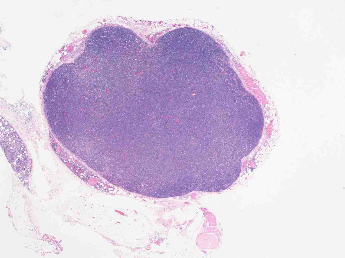 Lymph node 2010 HE 4X
